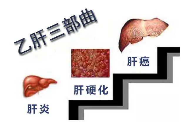 健康人感染乙肝的幾率是多少？